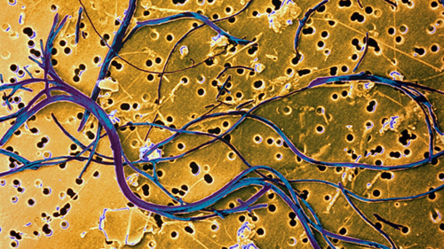 Microscope view of the surface of a gold-coated track-etched membrane with blue asbestos fibers