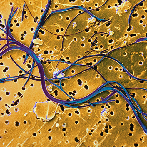 Microscope view of the surface of a gold-coated track-etched membrane with blue asbestos fibers